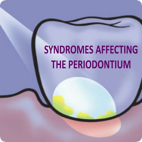 Syndromes affecting the periodontium