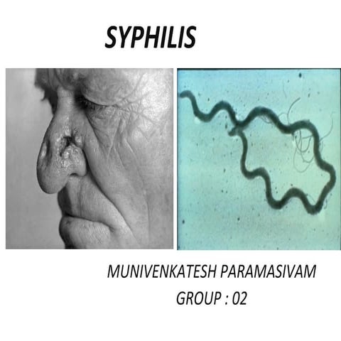 Syphilis
