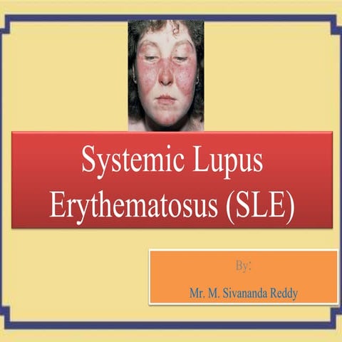 Systemic lupus