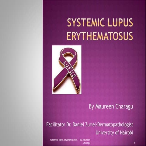 Systemic lupus erythematosus.