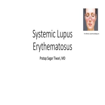 Systemic lupus erythematosus