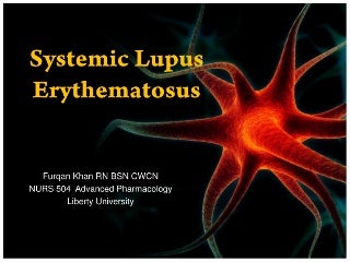 Systemic lupus erythematosus