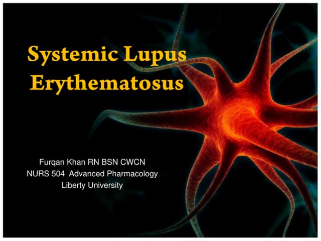 systemic lupus erythematosus | PPT