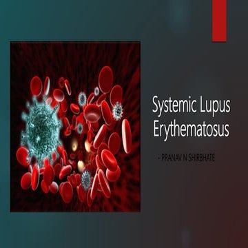 Systemic lupus erythematosus - Dr Pranav