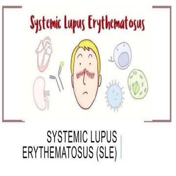 Systemic lupus erythematosus (sle)