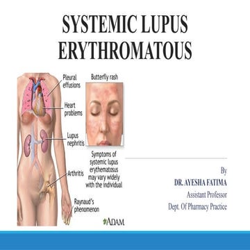 SYSTEMIC LUPUS ERYTHROMATOUS/ SLE  - Pharm D Notes .pptx