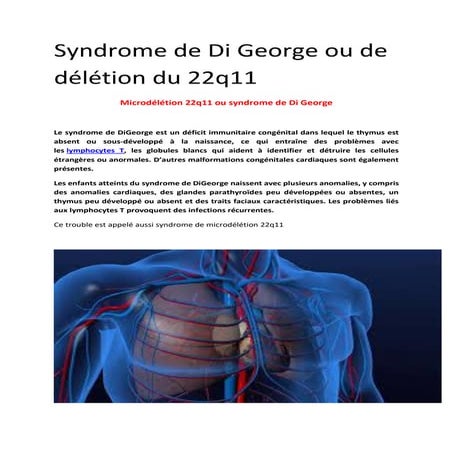 Syndrome de Di George : symptomes diagnostic et traitement | PDF