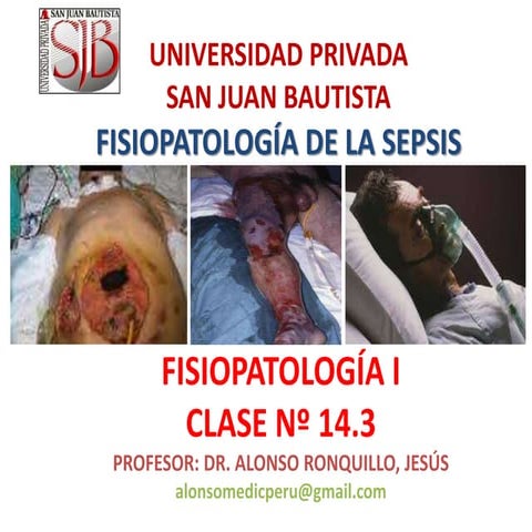 T-14.3 FP DE LA SEPSIS.pptx