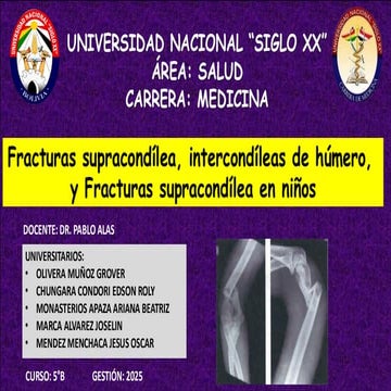 Fx supracondílea codo pediátrico | PPTX