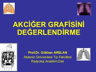Akciğer Grafisi değerlendirilmesi