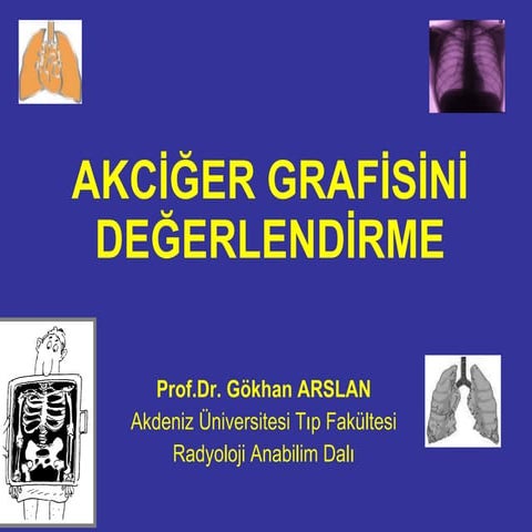 Akciğer Grafisi değerlendirilmesi