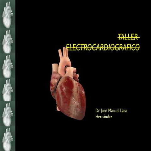Taller ekg i