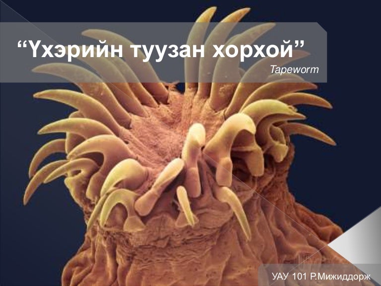 Туузан хорхой (Tapeworm)