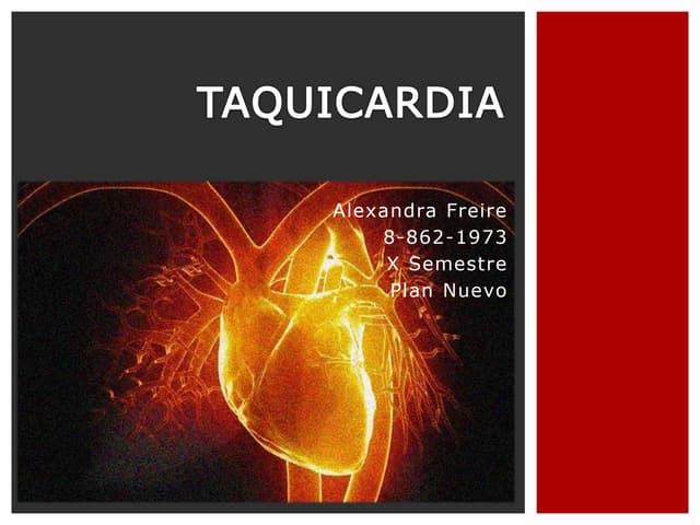 Arritmias Bradicardia E Taquicardia Arritmias Bradicardia E Taquicardia