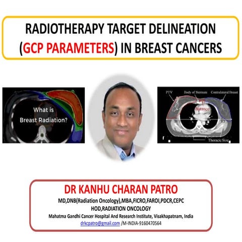 RADIOTHERAPY TARGET DELINEATION IN BREAST CANCER