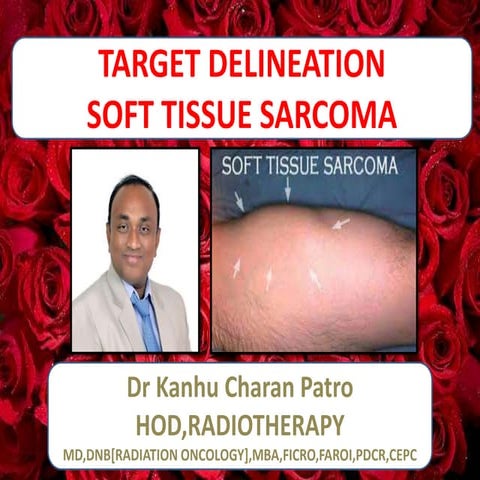 TARGET DELINEATION OF SOFT TISSUE SARCOMA | PPTX