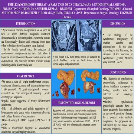 STOMAL RECURRENCE AFTER LARYNGECTOMY-1.pptx