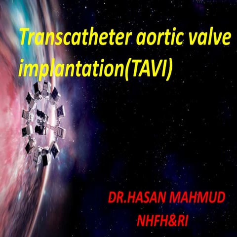 Tavi,Transcatheter Aortic Valve Replacement, TAVI,TAVR,