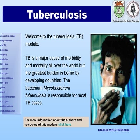 GA_PRDStIvoOverview-1.ppt TB Slides for General Students. Basics of TB ...