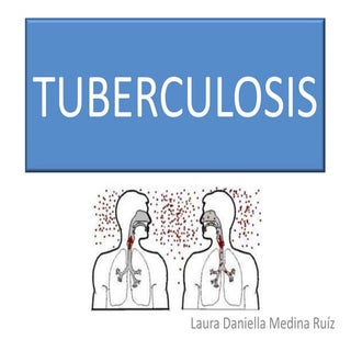 Tuberculosis