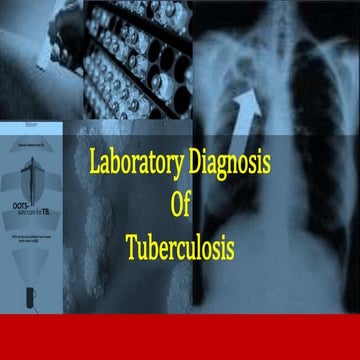labaratory diagnosis of tuberulosis.