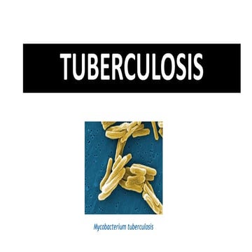 Tuberculosis