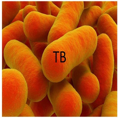tuberculosis