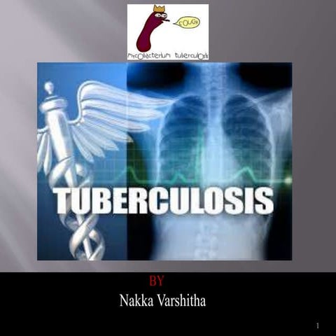 Tuberculosis