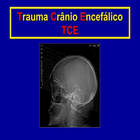 Tce | PDF