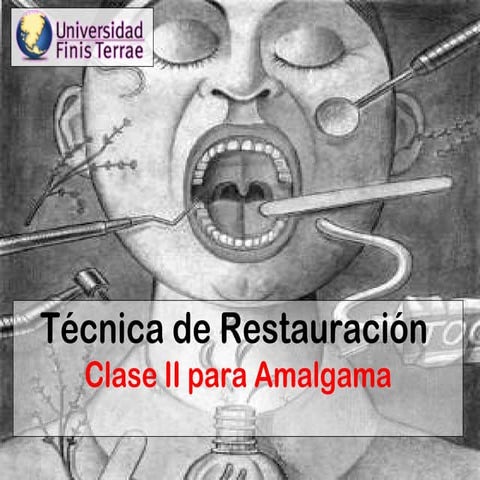 Técnica Restauradora para Amalgama Clase II