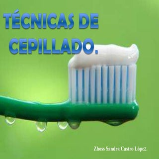 Técnicas de cepillado
