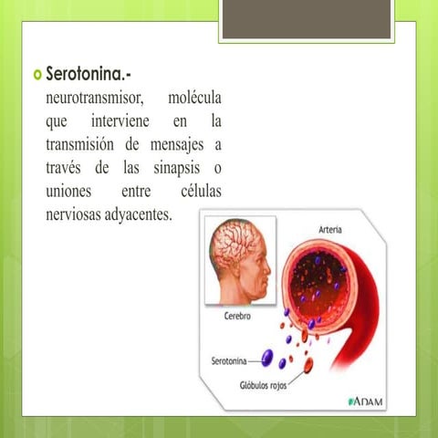 Trastornos del espectro autista