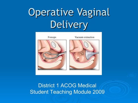 Forcep delivery | PPT