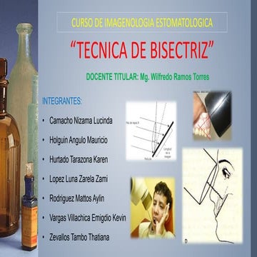Tecnica de bisectriz expocision