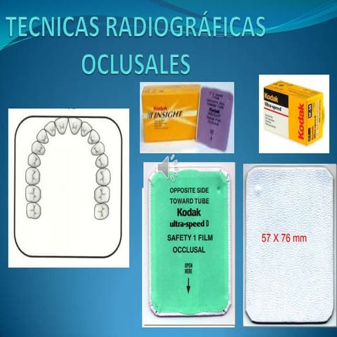 Tecnica oclusal 1