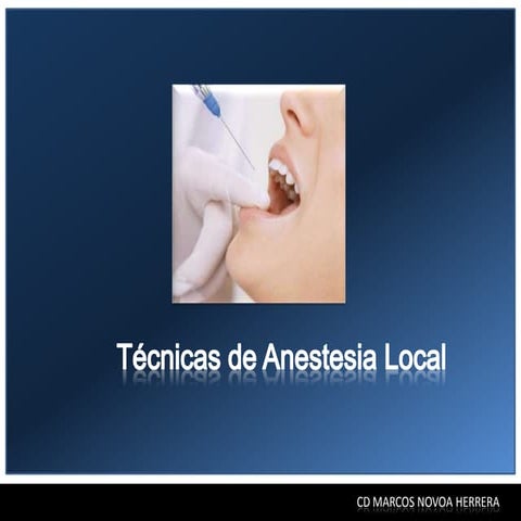 Tecnicas de anestesia local
