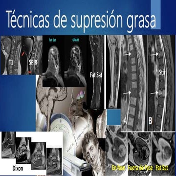 Tecnicas de supresion grasa [autoguardado]