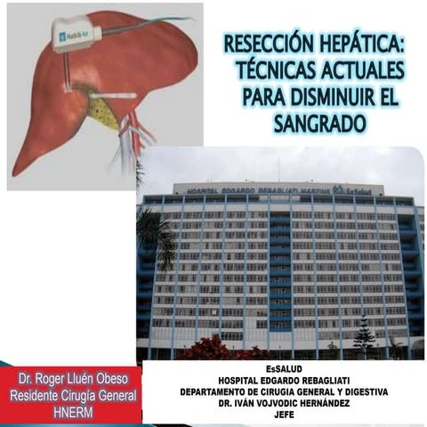 Tecnicas reseccion hepatica expo 1