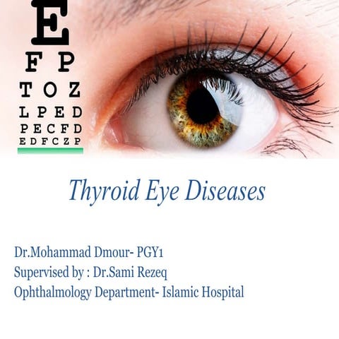 Thyroid eye disease | PPTX