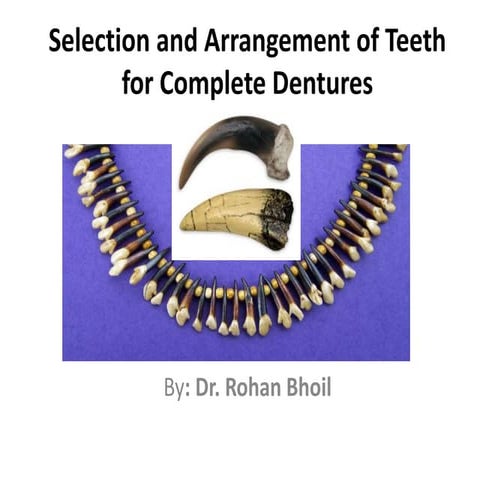 Teeth arrangement