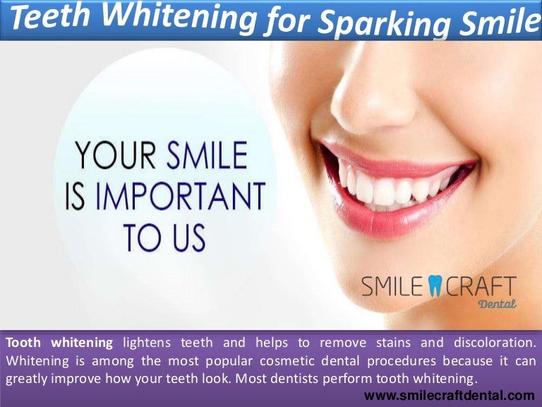 Sparkling smile. Гуд дентал. cosmetic dentistry maryland. smile important.