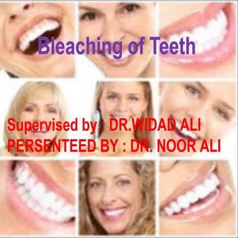 teeth bleaching