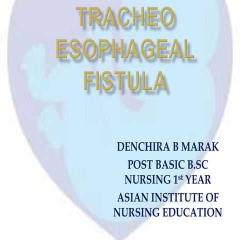 Tracheo Esophageal Fistula(TEF) | PPTX