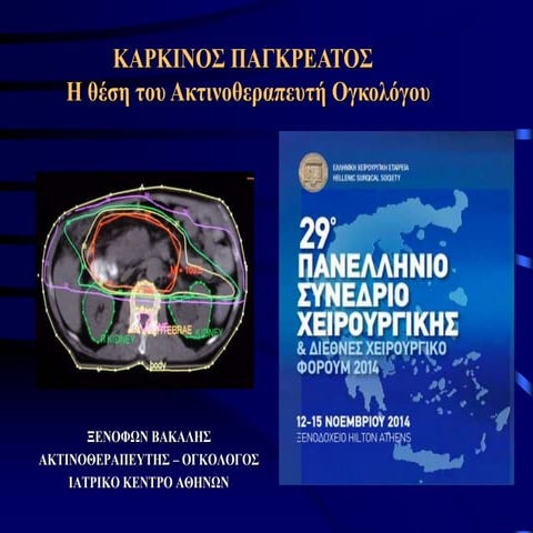 radiotherapy-pancreatic cancer