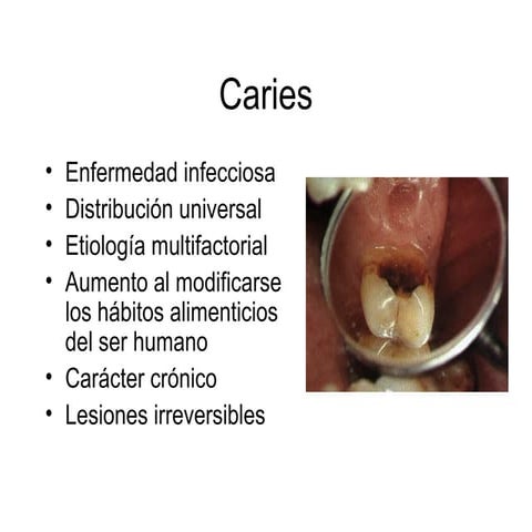 Microorganismos De La Caries Dental | PPT