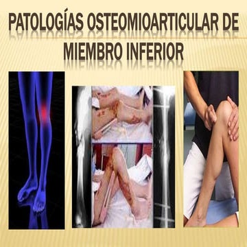 PATOLOGÍAS OSTEOMIOARTICULAR DE MIEMBRO INFERIOR
