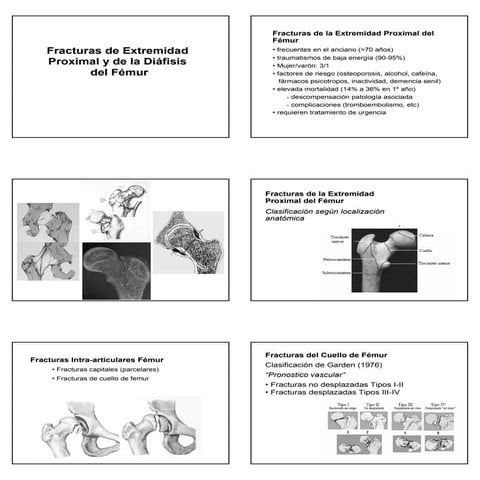 FRACTURAS VERTEBRALES CLASE DE TRAUMATOLOGIA Y ORTOPEDIA | PPTX
