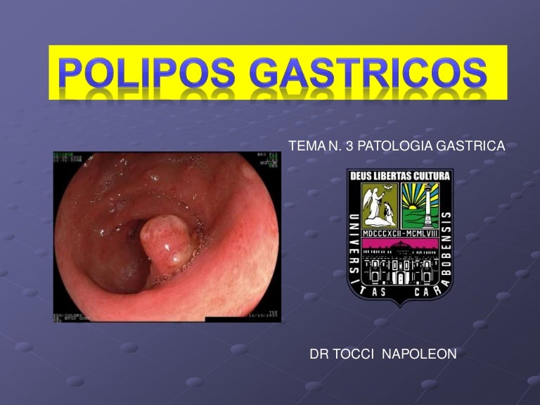 Tema 3 polipos gastricos carcinoma gastrico