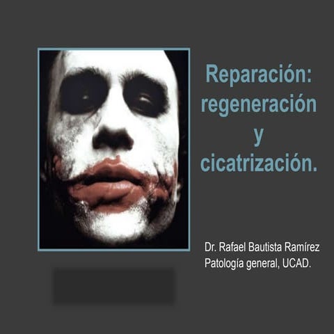 Tema 6. Reparación e histocicatrización.