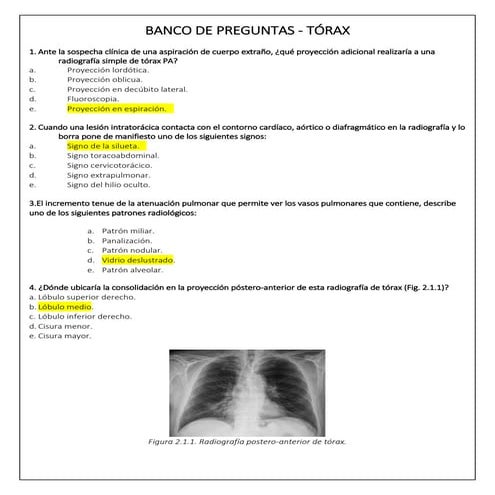 TEMARIO 1 - RADIODIAGNÓSTICO TORÁCICO